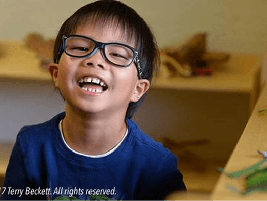 Child smiling with glasses and missing tooth.
